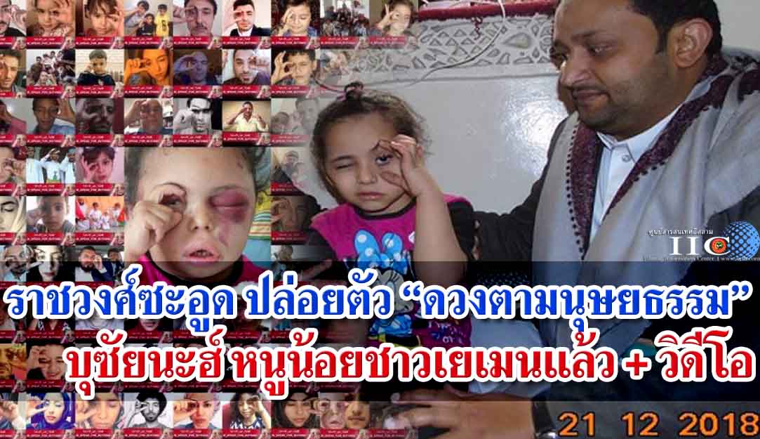 ราชวงศ์ซะอูด ปล่อยตัว “ดวงตามนุษยธรรม” หนูน้อยชาวเยเมนแล้ว + วิดีโอ